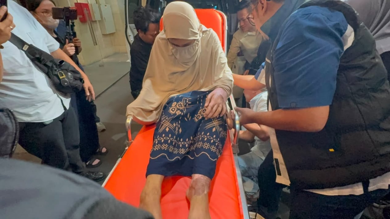 Kasus Dugaan Kekerasan Oknum Polisi: Korban Alami Luka Bakar Parah hingga Tulang Terlihat