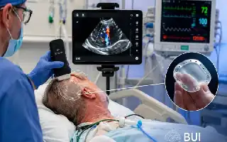 Inovasi Brain Ultrasound Interface: Terobosan Medis yang Mengubah Implan Kranial Menjadi 'Jendela' Diagnostik