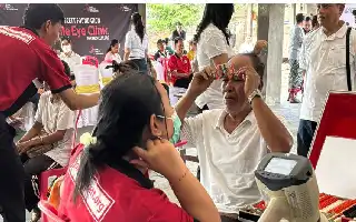 Perdami Bali Gelar Operasi Katarak Gratis, Tekan Angka Kebutaan di Gianyar