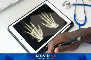 Bahaya Mengintai di Balik Nyeri Sendi: Pakar Ingatkan Risiko Kerusakan Organ Akibat Rematik Autoimun