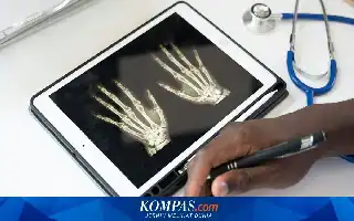 Bahaya Mengintai di Balik Nyeri Sendi: Pakar Ingatkan Risiko Kerusakan Organ Akibat Rematik Autoimun