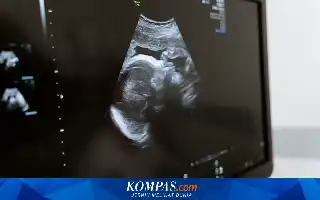 Teknologi AI Permudah Skrining Kehamilan di Wilayah Minim Dokter Spesialis