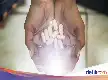 Tingkat Putus Obat HIV di Kotawaringin Barat Capai 46 Persen, Dinkes Gencarkan Pendampingan