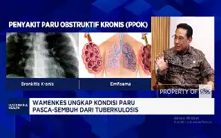 Kemenkes Perluas Skema Pelacakan TBC Nasional, Sasar 80 Ribu Desa