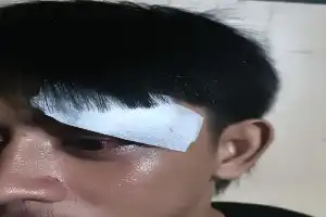 Kasus Penganiayaan Lurah Tomoni: Pelaku Mengaku Emosi, Korban Bantah Adanya Relasi Bisnis