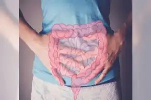 Mengapa Makanan Tinggi Lemak Memicu Kanker Usus? Studi Terbaru Ungkap Mekanisme Biologisnya