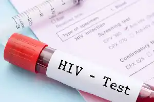 Deteksi Dini Meluas, Kemenkes Klarifikasi Penyebab Kenaikan Temuan Kasus HIV di Sidoarjo