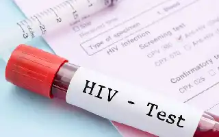Deteksi Dini Meluas, Kemenkes Klarifikasi Penyebab Kenaikan Temuan Kasus HIV di Sidoarjo