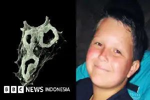Kewaspadaan Global Meningkat: Mengapa Ameba 'Pemakan Otak' Kini Merambah Berbagai Belahan Dunia?